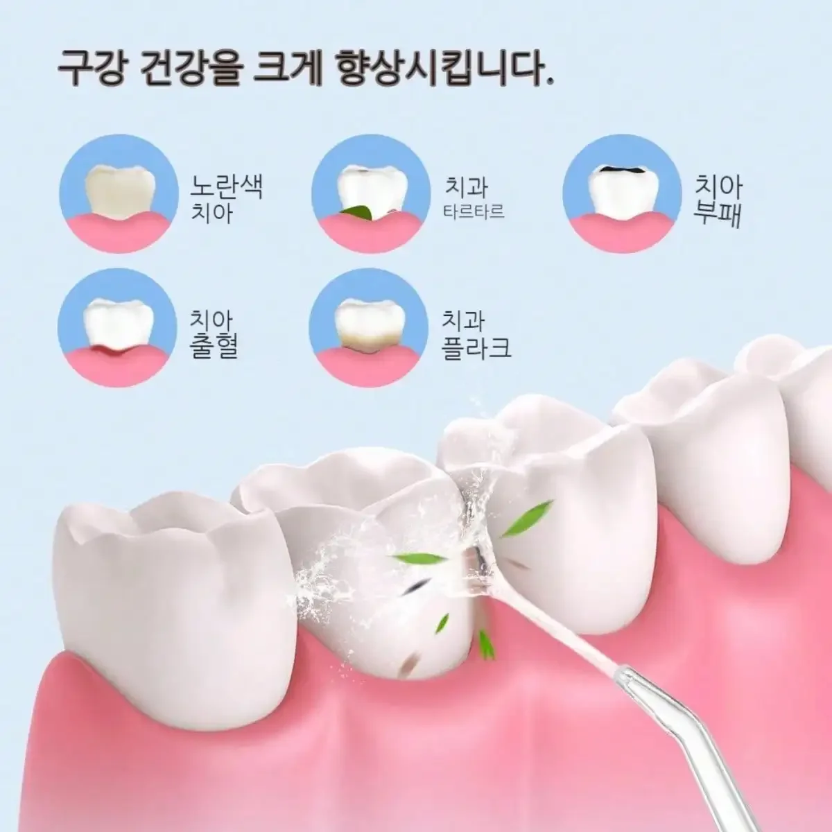 Hilo de agua el&eacute;ctrico, chip inteligente, control preciso de presi&oacute;n, boquilla giratoria de 360 ​​grados, dispositivo de limpieza dental