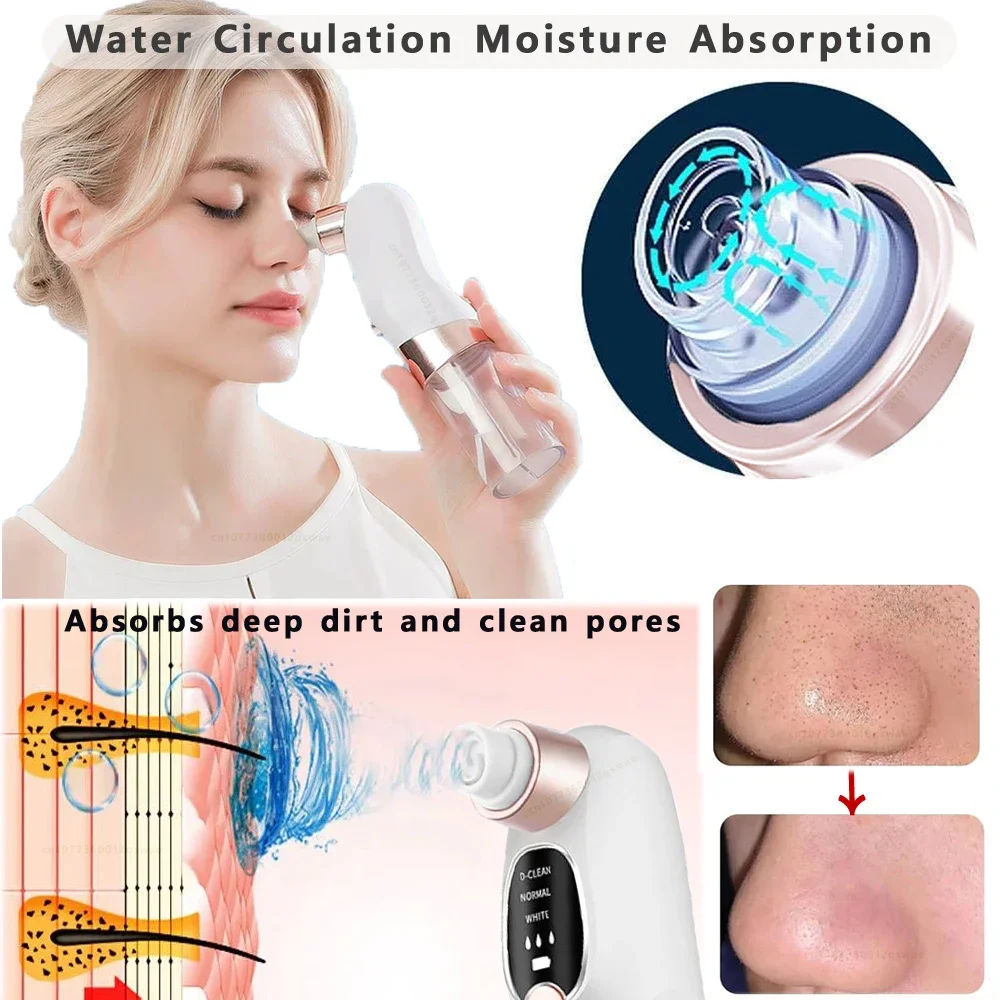 Removedor de espinillas, aspirador de poros, limpiador facial el&eacute;ctrico, espinillas, acn&eacute;, eliminaci&oacute;n de cabeza negra, recargable por USB, ciclo de agua, eliminaci&oacute;n de puntos negros
