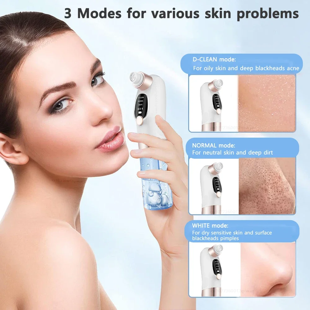Removedor de espinillas, aspirador de poros, limpiador facial el&eacute;ctrico, espinillas, acn&eacute;, eliminaci&oacute;n de cabeza negra, recargable por USB, ciclo de agua, eliminaci&oacute;n de puntos negros