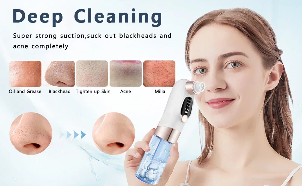 Removedor de espinillas, aspirador de poros, limpiador facial el&eacute;ctrico, espinillas, acn&eacute;, eliminaci&oacute;n de cabeza negra, recargable por USB, ciclo de agua, eliminaci&oacute;n de puntos negros